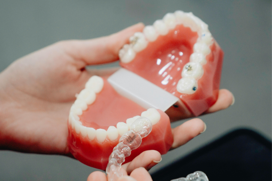 Typodent z nakładkami Invisalign